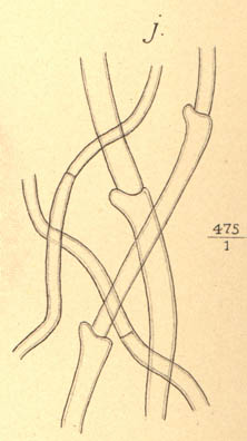 Pseudohydnum gelatinosum