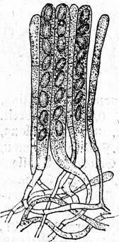 Ascomycota